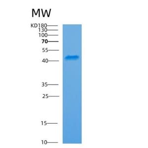 Recombinant Human ARFIP1 Protein,Recombinant Human ARFIP1 Protein