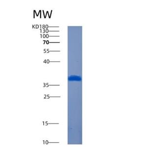 Recombinant Human AMMECR1L Protein,Recombinant Human AMMECR1L Protein