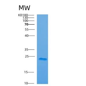 Recombinant Human ARF5 Protein,Recombinant Human ARF5 Protein