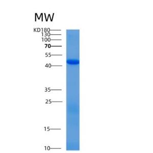 Recombinant Human Alix Protein