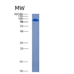 Recombinant Mouse Angiotensin-converting enzyme 2 Protein