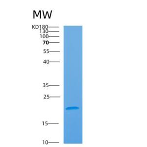 Recombinant Human ARL2BP Protein