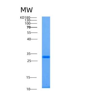 Recombinant Human ALKBH2 Protein