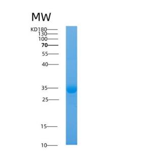 Recombinant Human AMD1 Protein