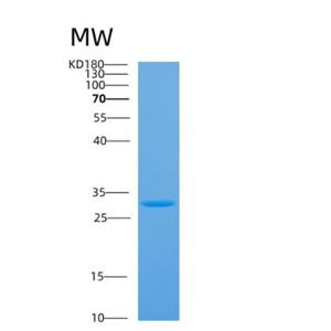 Recombinant Human ANP32A Protein,Recombinant Human ANP32A Protein