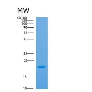 Recombinant Human AP1S2 Protein,Recombinant Human AP1S2 Protein