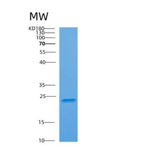 Recombinant Human Aprataxin Protein,Recombinant Human Aprataxin Protein