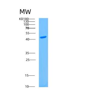 Recombinant Human AS3MT Protein,Recombinant Human AS3MT Protein