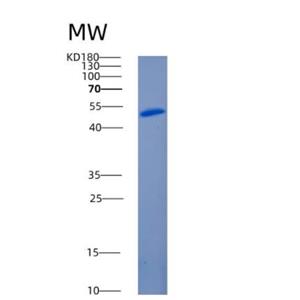 Recombinant Human ANGPTL3 Protein