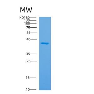 Recombinant Human APEX1 Protein