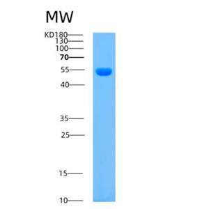 Recombinant Mouse Arsa Protein