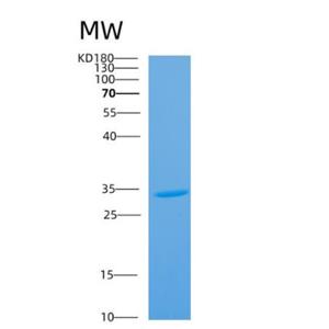 Recombinant Human ANTXR2 Protein