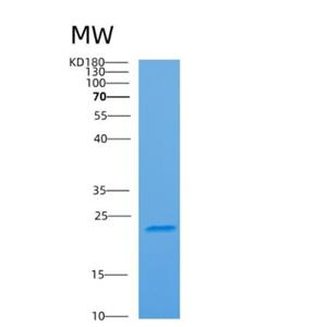 Recombinant Human ARF4 Protein,Recombinant Human ARF4 Protein