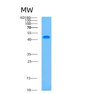 Recombinant Human ASCC1 Protein,Recombinant Human ASCC1 Protein