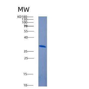 Recombinant Human Annexin A3 Protein,Recombinant Human Annexin A3 Protein