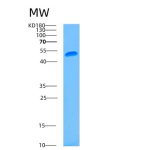 Recombinant Human ASL Protein,Recombinant Human ASL Protein