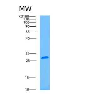 Recombinant Human ASGR2 Protein