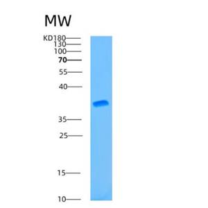 Recombinant Human ATG3 Protein