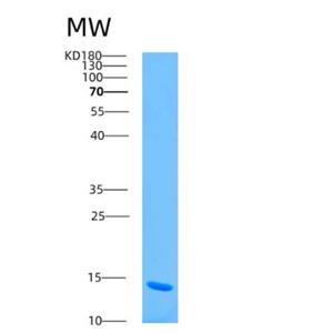 Recombinant Human ARSM2 Protein