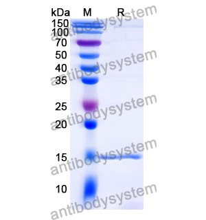 抗 Human CD16b/FCGR3B 纳米抗体 (SAA1310)(RHB05701),Anti-Human CD16b/FCGR3B Nanobody (SAA1310)