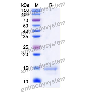 抗 Human CCL2/MCP-1 纳米抗体 (SAA1269)(RHC97801),Anti-Human CCL2/MCP-1 Nanobody (SAA1269)