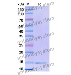 抗 Human CD132/IL2RG 纳米抗体 (SAA1050)(RHD96701),Anti-Human CD132/IL2RG Nanobody (SAA1050)