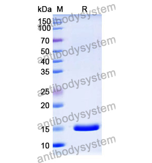 抗 Human IGKC 納米抗體 (SAA1354)(RHD36902),Anti-Human IGKC Nanobody (SAA1354)