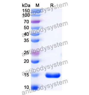 抗 Porphyromonas gingivalis porM 納米抗體 (SAA1181)(RXX05904),Anti-Porphyromonas gingivalis porM Nanobody (SAA1181)