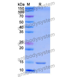 抗 Human NOTCH2 納米抗體 (SAA1287)(RHG01801),Anti-Human NOTCH2 Nanobody (SAA1287)