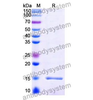 抗 Vibrio cholerae serotype O1 higB-2 納米抗體 (SAA1035)(RXX10106),Anti-Vibrio cholerae serotype O1 higB-2 Nanobody (SAA1035)