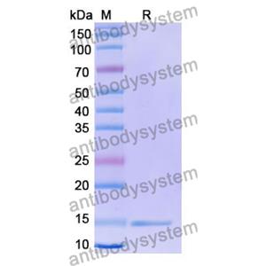 Anti-Human CD132/IL2RG Nanobody (SAA1050)