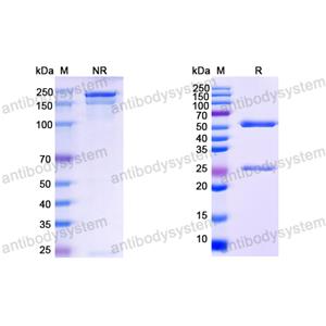 抗体：EBV/HHV-4 LMP1/BNLF1 Antibody (H3) RVV07011