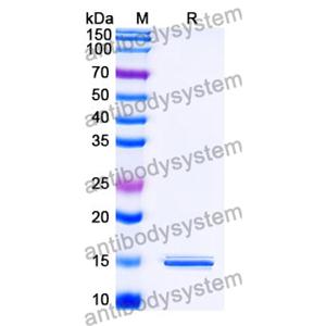 抗 SARS-CoV-2 S Protein 納米抗體 (SAA1099)(RVV00177),Anti-SARS-CoV-2 S Protein Nanobody (SAA1099)