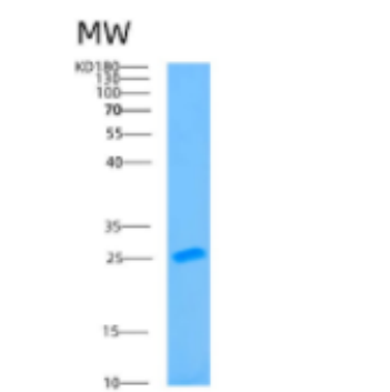 Recombinant Human B9D1 Protein,Recombinant Human B9D1 Protein