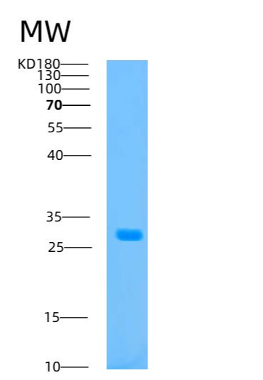 Recombinant Human ATP1B2 Protein,Recombinant Human ATP1B2 Protein