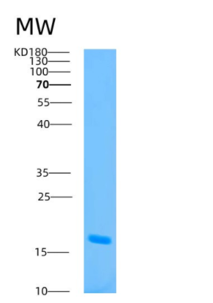 Recombinant Human ATP5D Protein,Recombinant Human ATP5D Protein