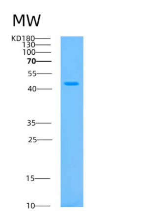 Recombinant Human Aurora kinase A Protein,Recombinant Human Aurora kinase A Protein