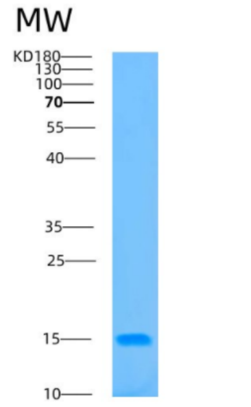 Recombinant Human B2M Protein,Recombinant Human B2M Protein