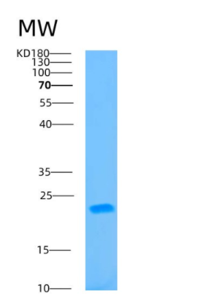 Recombinant Human B9D2 Protein,Recombinant Human B9D2 Protein