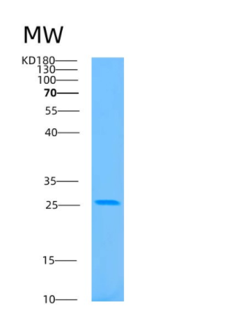 Recombinant Human BAG1 Protein,Recombinant Human BAG1 Protein