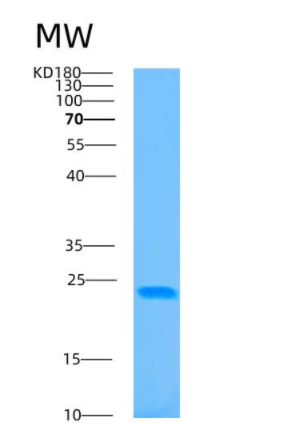 Recombinant Human 4-1BB ligand Protein,Recombinant Human 4-1BB ligand Protein