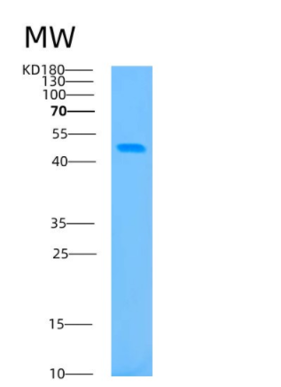 Recombinant Human BCAT1 Protein,Recombinant Human BCAT1 Protein