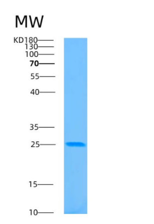 Recombinant Human BASP1 Protein,Recombinant Human BASP1 Protein