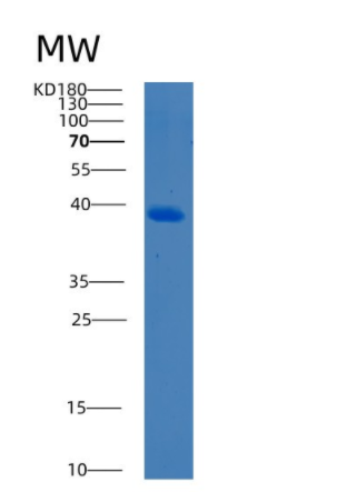 Recombinant Human BCCIP Protein,Recombinant Human BCCIP Protein