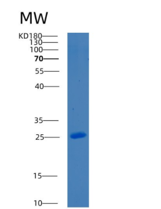 Recombinant Mouse Bcl-2-like-protein 1 Protein,Recombinant Mouse Bcl-2-like-protein 1 Protein