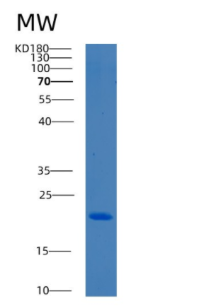 Recombinant Human BCL2L10 Protein,Recombinant Human BCL2L10 Protein