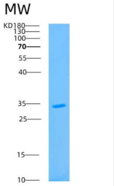 Recombinant Human AUH Protein,Recombinant Human AUH Protein