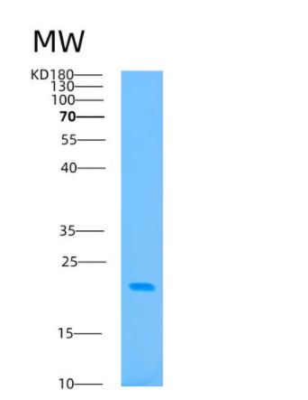 Recombinant Human BAP18 Protein,Recombinant Human BAP18 Protein