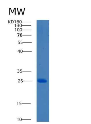 Recombinant Human BCL7C Protein,Recombinant Human BCL7C Protein