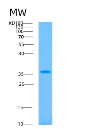 Recombinant Human B3GAT3 Protein,Recombinant Human B3GAT3 Protein